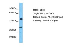 LPGAT1 Rabbit anti-Human, Polyclonal, Novus Biologicals 0.1ml; Unconjugated:Antibodies,